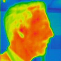 Thermography